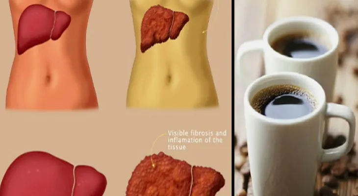 Cuida tu hígado, de enfermedades como el cáncer, consumiendo café