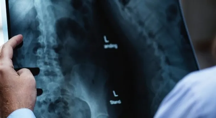 Curiosos objetos que son "olvidados" por pacientes dentro de sus cuerpos