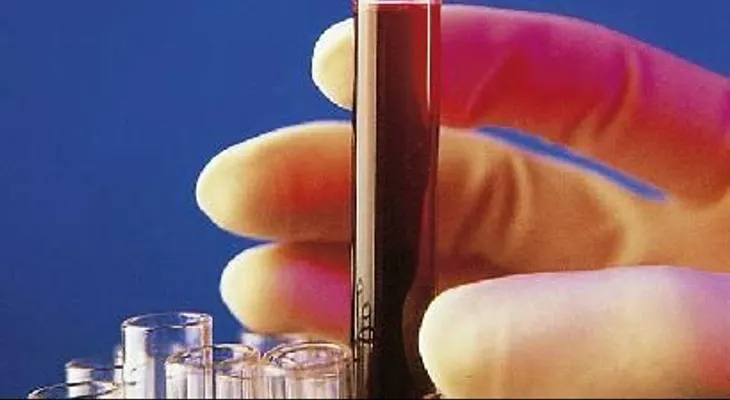 Detectar varios tipos de cáncer con una sola muestra de sangre