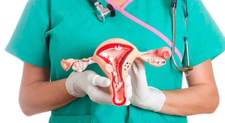  Cáncer de ovario: A veces también sorprende a la mujer joven 