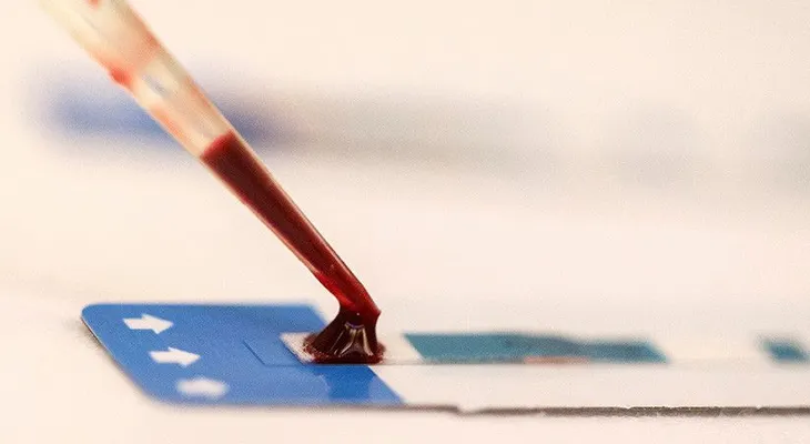 Un tercer paciente se habría curado del VIH con trasplante de médula ósea