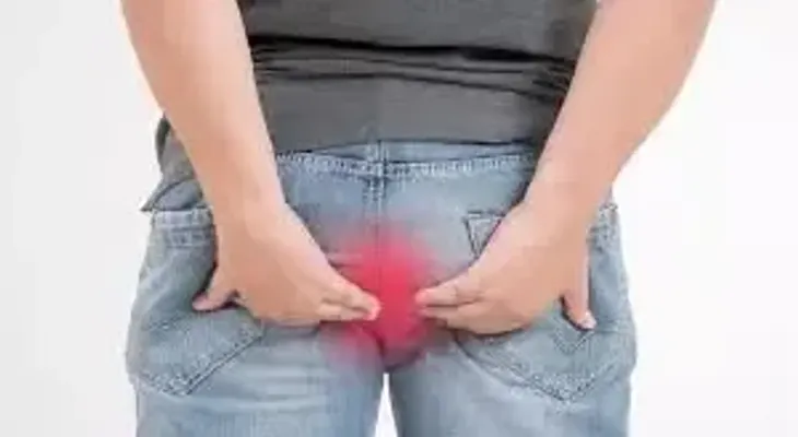 Imperdibles consejos para prevenir y tratar las hemorroides 