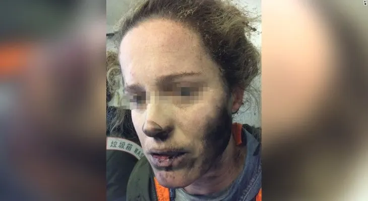 Auriculares de una pasajera se incendian en pleno vuelo