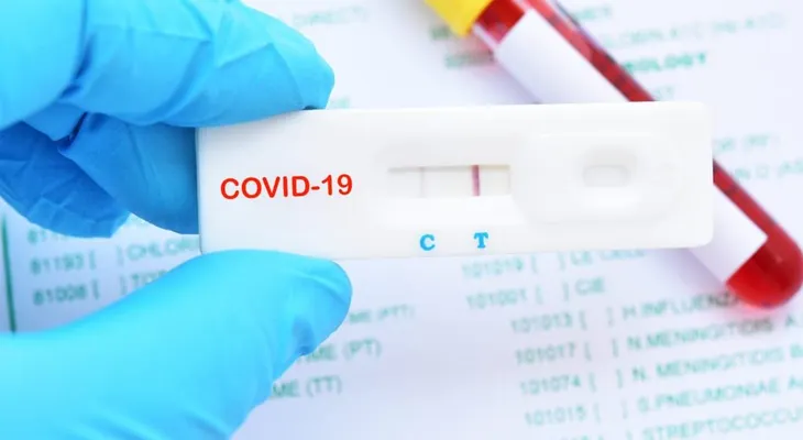 EEUU autoriza por 1ra vez un test de anticuerpos de coronavirus que se hace en casa