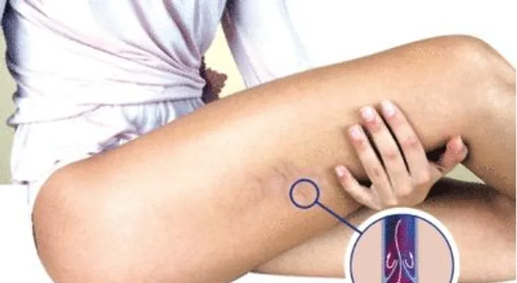 Simples trucos para combatir la mala circulación de las piernas 