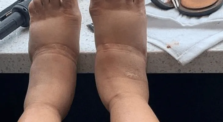 Cardi B y sus pies hinchados de los que todos hablan