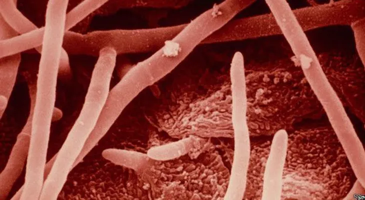 5 infecciones que se pueden contraer en un vestuario.