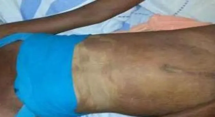 Identifican como Yarisa Adon (La flaca), mujer encontrada muerta en hotel de Villa Francisca 