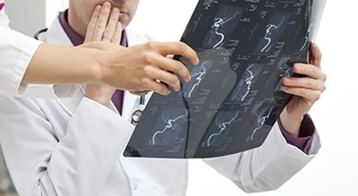 TAC: Una técnica no invasiva que detecta enfermedades