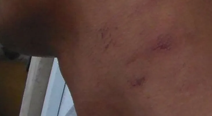 Jóvenes denuncian golpiza de parte de policías en Dajabón