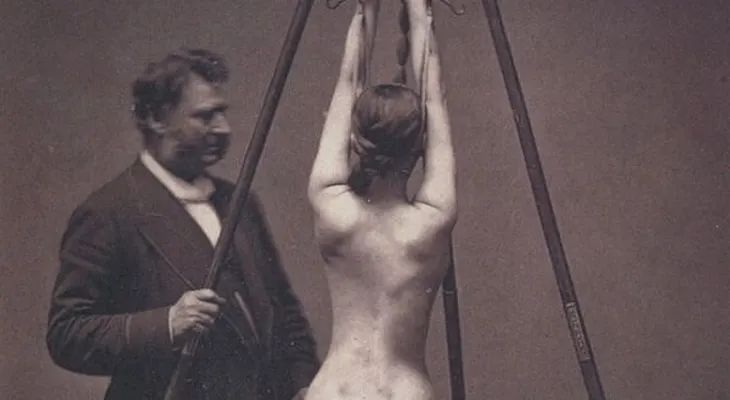 Imágenes chocantes y aterradoras...17 terribles secretos de la medicina del pasado