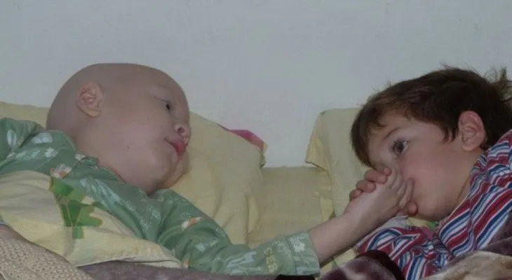Una prometedora esperanza para los niños que sufren de leucemia agresiva