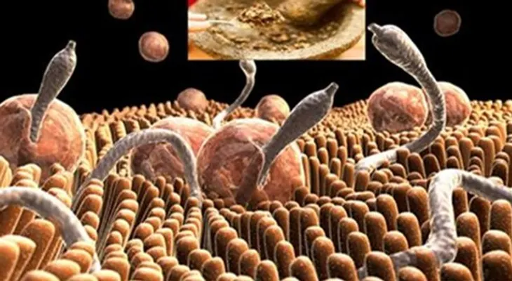 Como eliminar las amebas y otros parásitos de tu CUERPO
