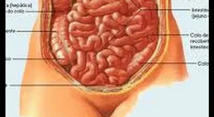 Remedio para el estrenÌ?imiento y la colitis: Inflamación del intestino y colon irritable (Video)