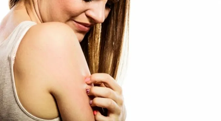 La inflamación en la piel causada por la psoriasis puede afectar las articulaciones