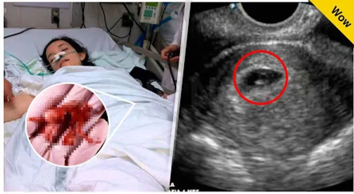 Ella perdió a su bebé en un aborto y Dios le dio esta lección (VIDEO)