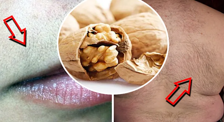 Elimina el vello de la cara y el cuerpo con esta sencilla receta