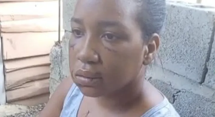 Mujer relata cómo sobrevivió a 26 puñaladas de su expareja en La Vega