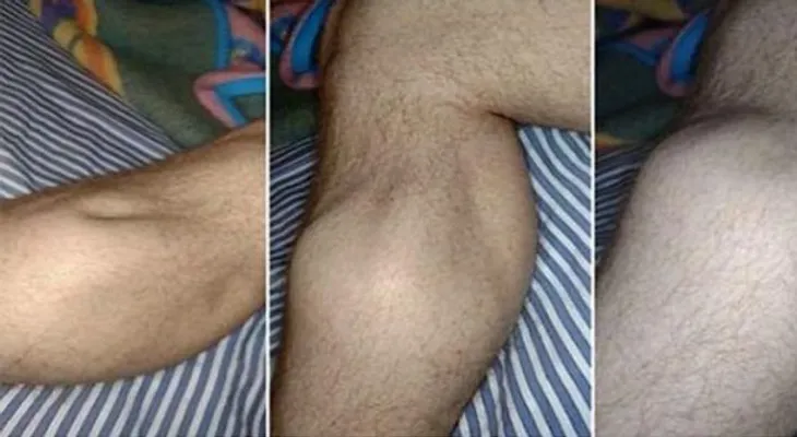 Con esto nunca más volverás a sufrir de calambres en la pierna
