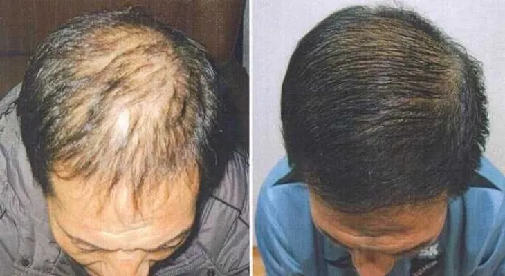 Este producto hará que tu pelo empiece a crecer como loco en una semana