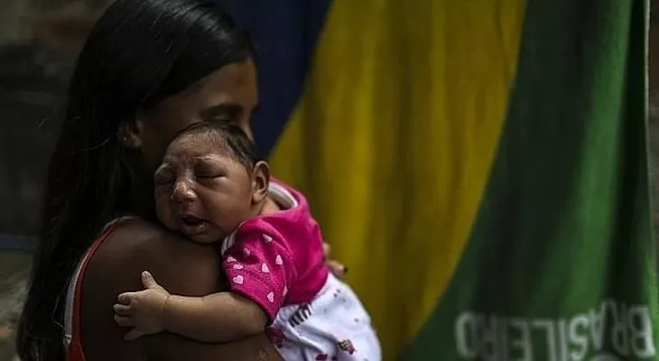 Nacen en EEUU tres bebés con defectos congénitos por zika