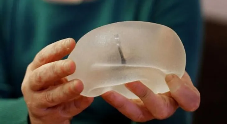 Los implantes de senos: "Por ahorrarnos tres pesos, nos arriesgamos a una complicación"