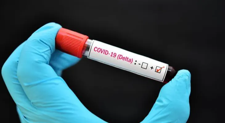 RD espera resultados sobre la presencia variante Delta del covid-19