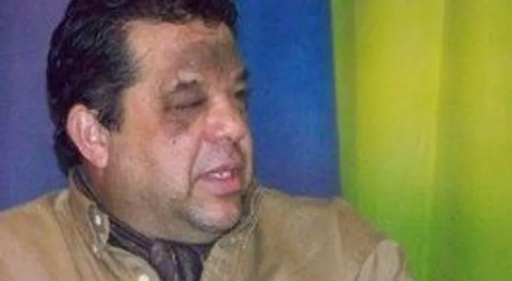 Chino Estrella espera ayuda urgente para someterse a una operación en Cuba 