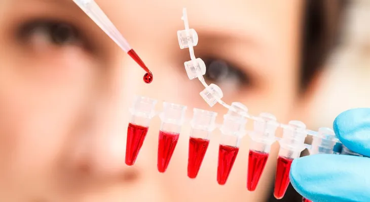 Desarrollan un revolucionario análisis de sangre que localiza un cáncer sin cirugías invasivas