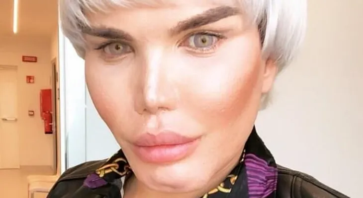 El "Ken Humano" parece una doña marciana, tras su última cirugía plástica