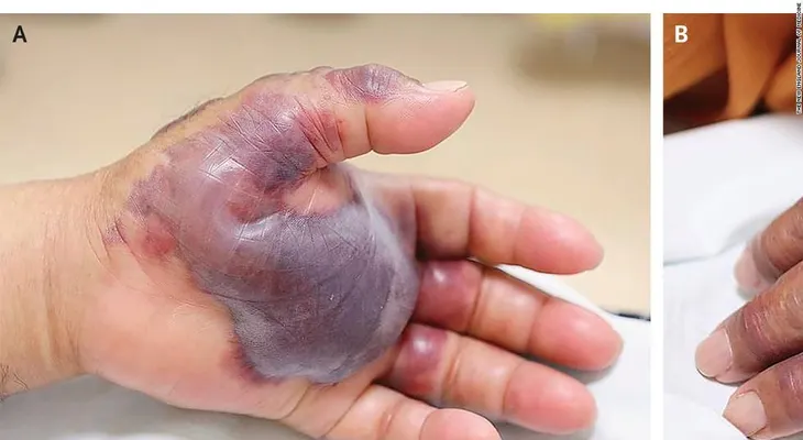 Piensa dos veces antes de comer pescado crudo... esta es la razón