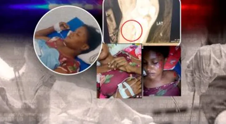 Joven de Nagua solicita traslado a Santo Domingo para cirugías tras accidente