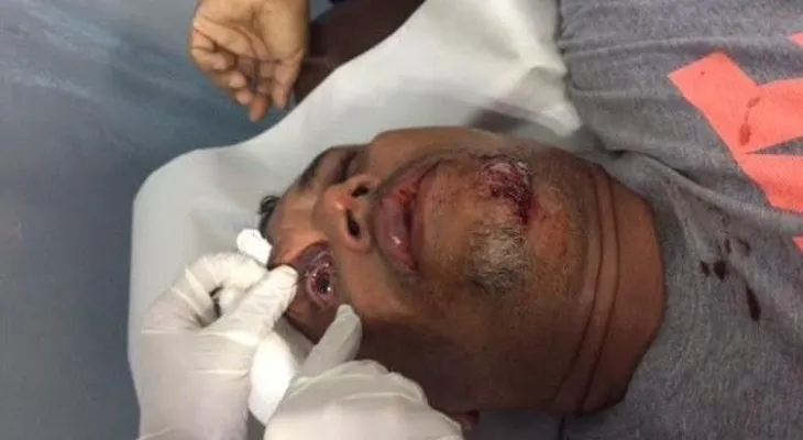 Fotógrafos rechazan "intenciones" de la PN de acusar a Danny Polanco