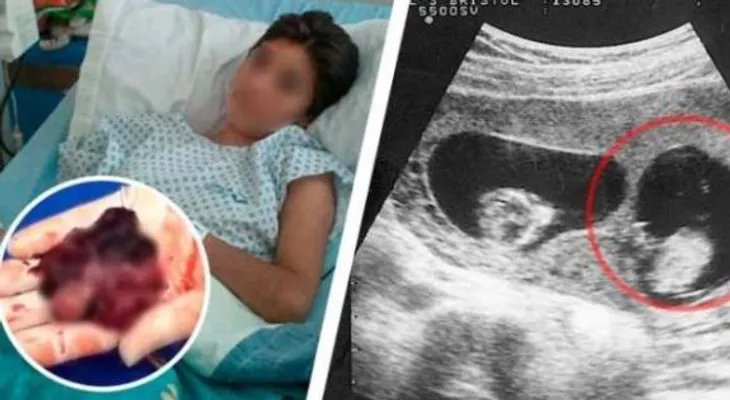 Ella decidió no tener a su hijo y DIOS le dio una lección que jamás olvidará