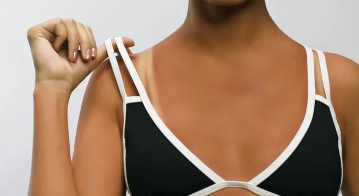5 señales de la piel que indican problemas en el cuerpo