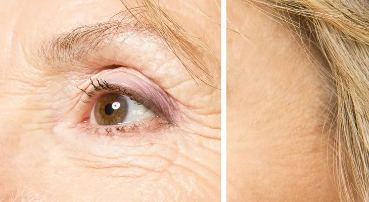 Cómo lucir más joven y con menos arrugas con remedios naturales