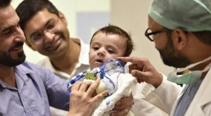 Cirujanos indios operan con éxito a un bebé que nació con ocho extremidades