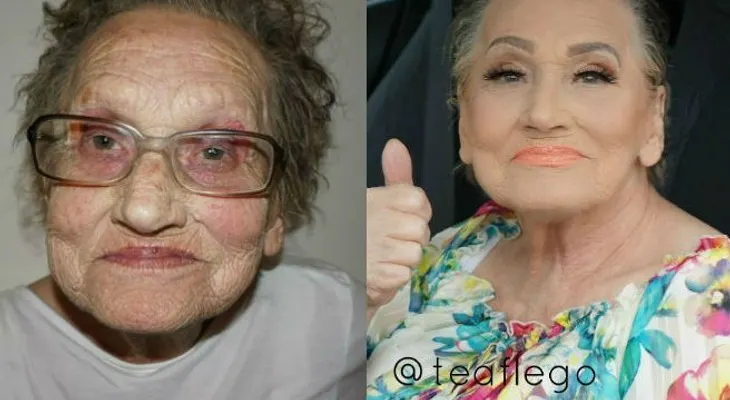 Mi mamá usa este gel y rejuvenece su piel en 5 minutos