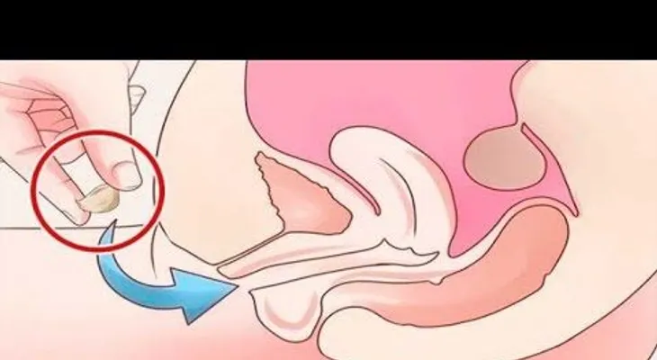 Coloca un pedazo de ajo en la vagina o en tu oído y verás que algo increíble pasará en tu cuerpo en minutos