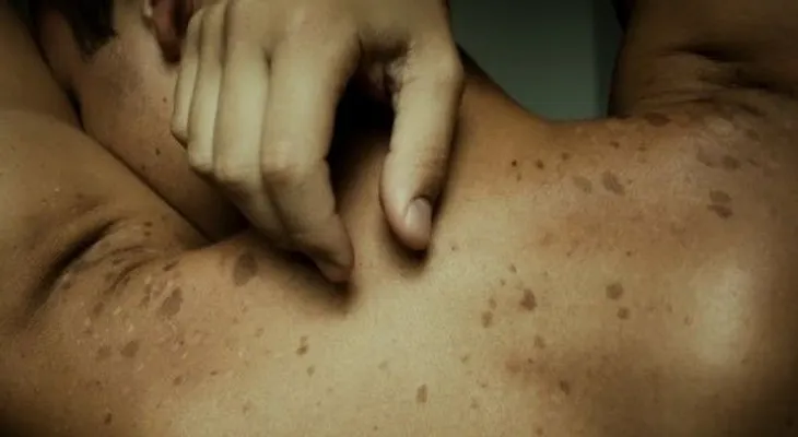 12 síntomas pueden alertar varios tipos de cáncer