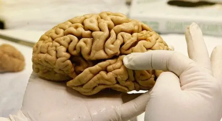 Ventajas y desventajas de los cerebros de las personas creativas, según la ciencia
