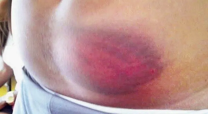 Envían a la cárcel Policías por torturas a presos en Los Alcarrizos 