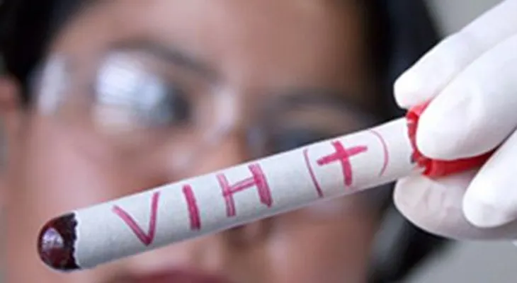  El VIH-sida se alimenta de la crisis venezolana 
