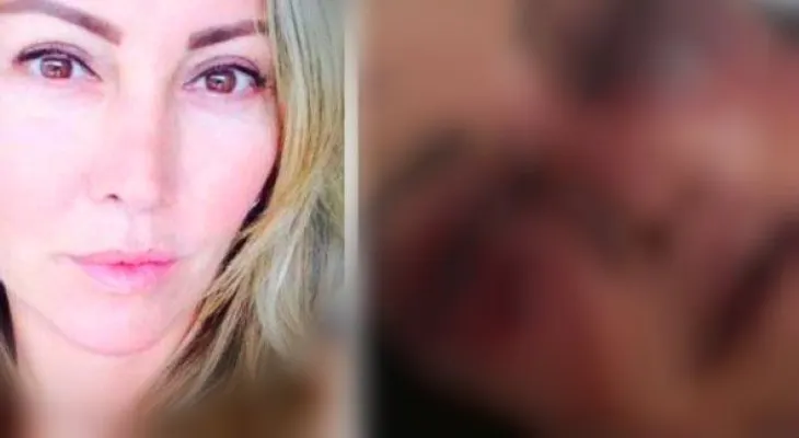 Una empresaria conoce un hombre por Facebook, y casi la mata en la 1ra cita 