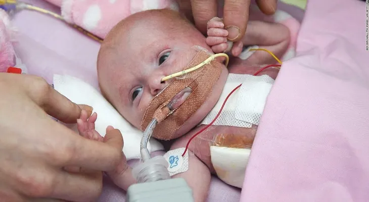 Esta bebé nació con el corazón por fuera de su cuerpo: así sobrevivió