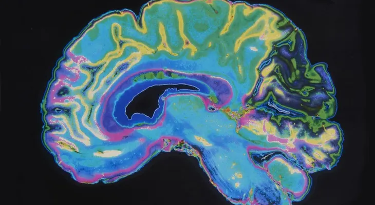 Cinco claves para mantener un cerebro activo toda la vida