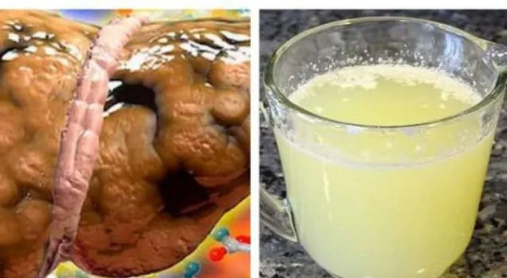 Si tomas este zumo nunca más tendrá higado graso 