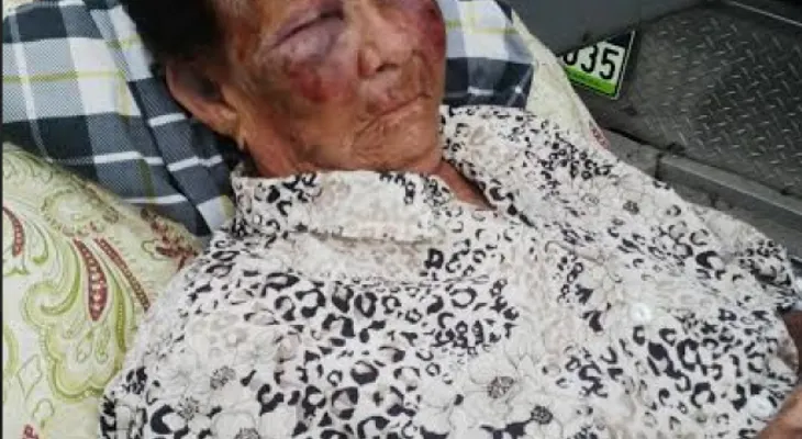 Delincuentes asaltan y golpean anciana de 90 años 
