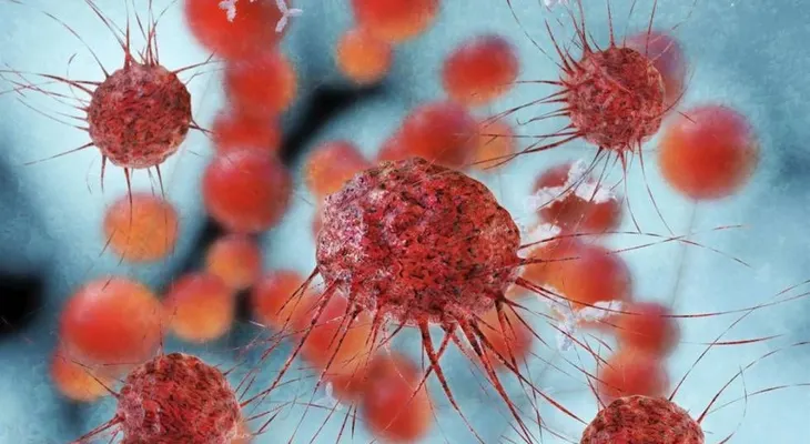  Inmunoterapia demuestra eficacia cáncer vejiga en estadios avanzados 