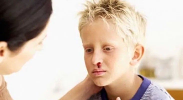 La hemofilia es una condición hereditaria y rara en mujeres